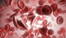 blood clot misdiagnosis